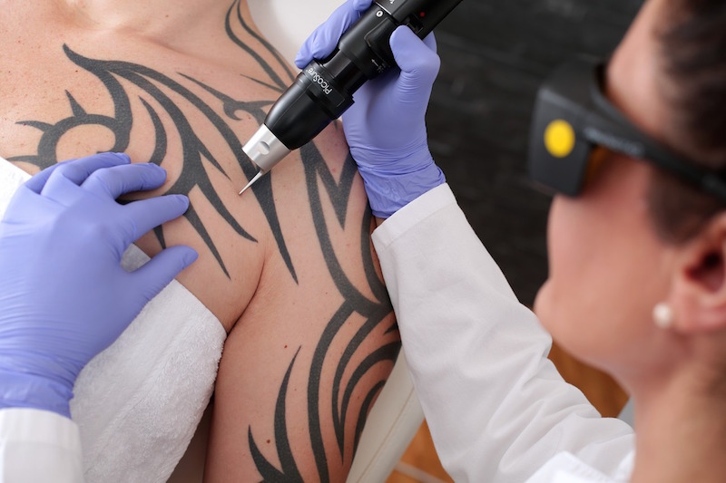 close up of tattoo tattoo removal insurance