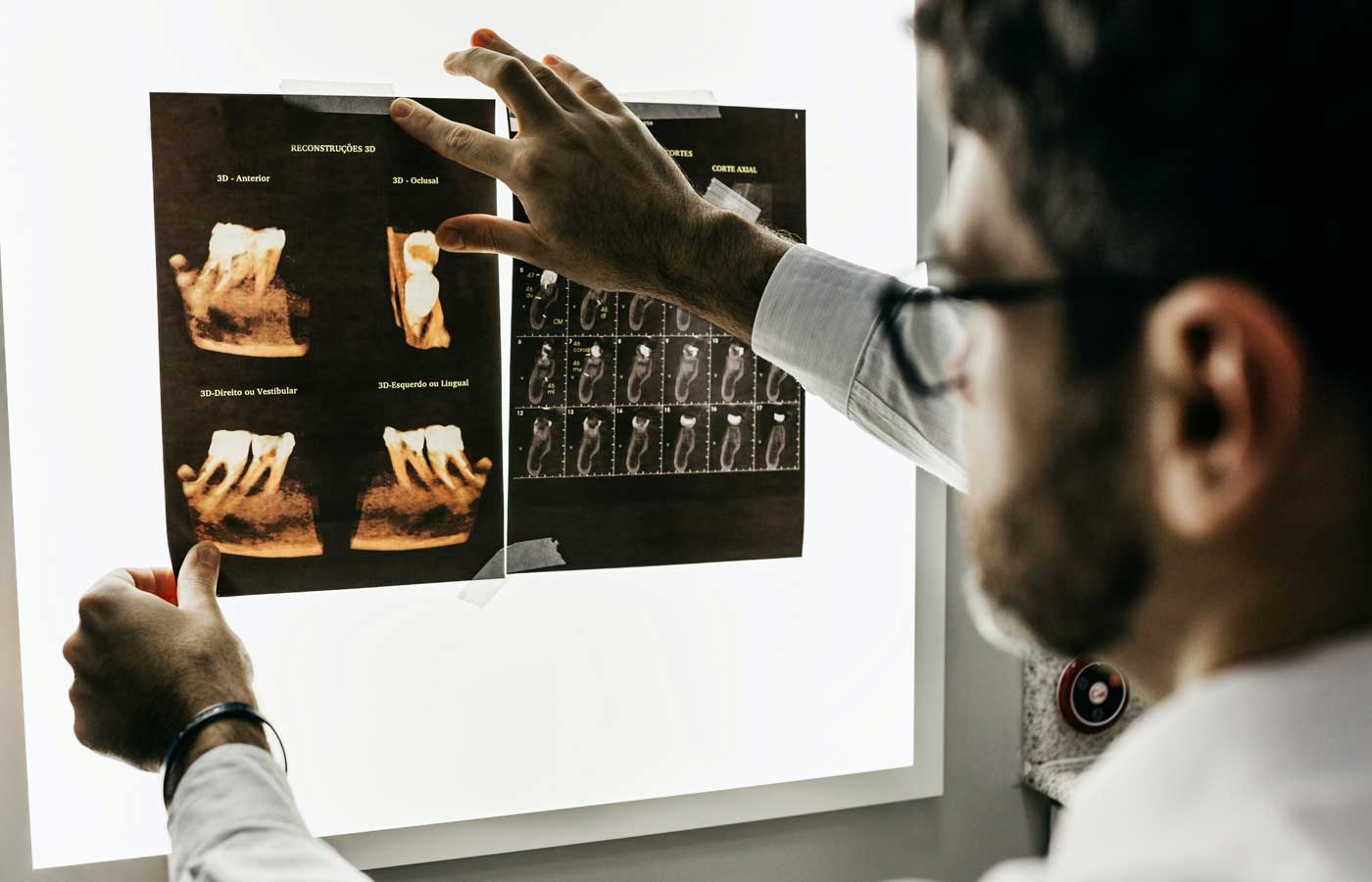 Reviewing patient teeth X-rays